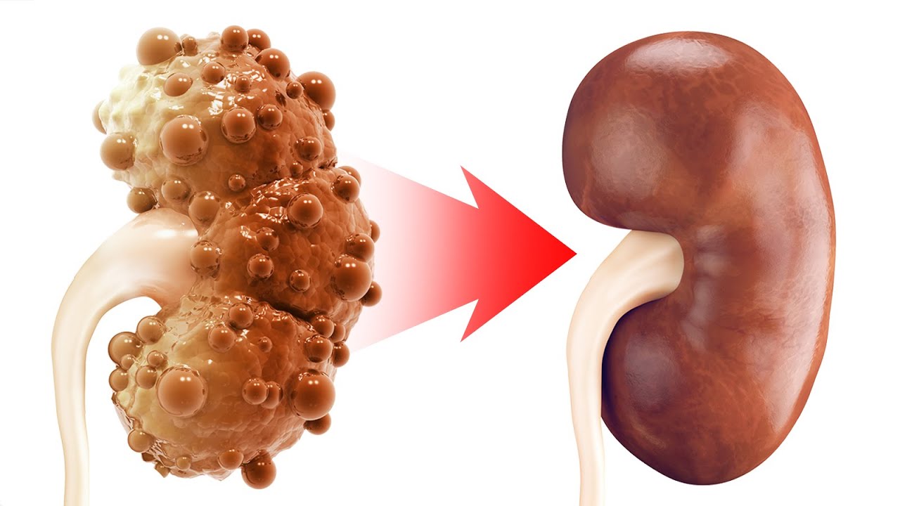Kidneys