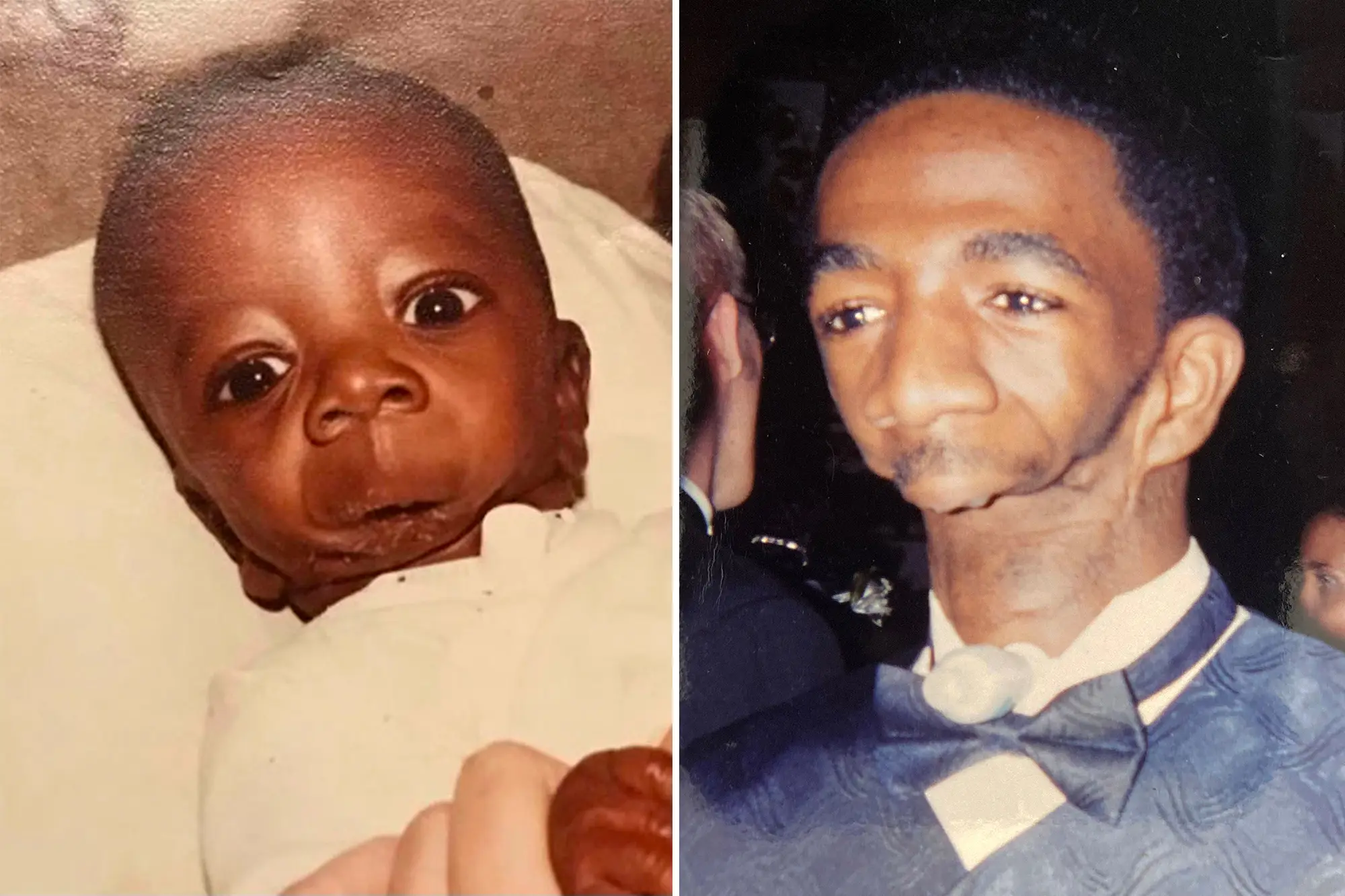 MAN BORN WITHOUT A JAW HP 9