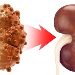 Kidneys