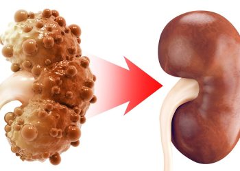 Kidneys